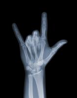 Nick Veasey